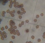 Psilocybe guilartensis image