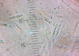 Mitrula elegans image