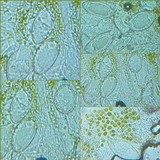 Pertusaria hymenea image