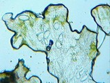 Pertusaria hymenea image
