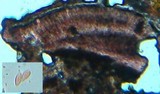 Tephromela atra var. atra image