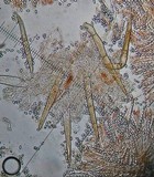 Cheilymenia fimicola image