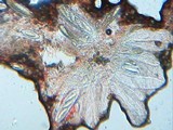 Pertusaria hymenea image