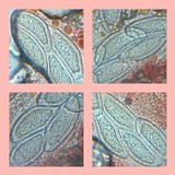 Pertusaria hymenea image