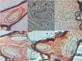 Pertusaria hymenea image