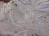 Pertusaria hymenea image