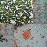 Arthonia atra image