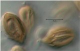 Austrogautieria clelandii image