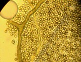 Lycoperdon subcretaceum image