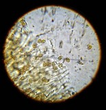 Inocybe hystrix image