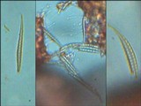Bacidia heterochroa image