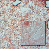 Lecidella elaeochroma f. elaeochroma image