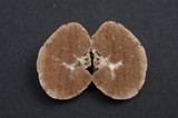Gautieria monticola image