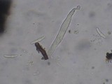 Glonium stellatum image