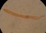 Glonium stellatum image