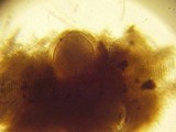 Thelebolus stercoreus image