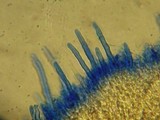 Hyphodontia subalutacea image