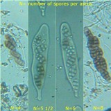 Diploschistes scruposus image