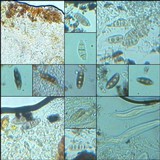 Pyrenula macrospora image