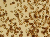 Hemistropharia albocrenulata image