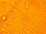 Exidia nucleata image