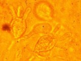 Exidia nucleata image