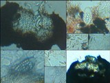 Arthonia calcarea image