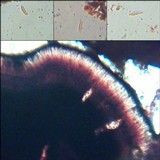Toninia aromatica image