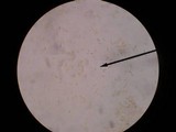 Xanthoconium purpureum image