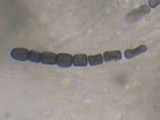 Thuemenella cubispora image