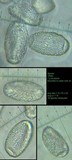 Erysiphe platani image