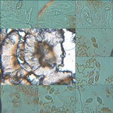 Leptogium cochleatum image