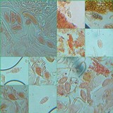 Collema bachmanianum image