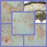 Lobothallia alphoplaca image