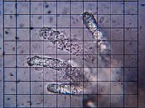 Irpex lacteus image