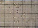 Irpex lacteus image
