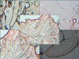 Pertusaria leioplaca image