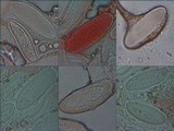 Pertusaria leioplaca image