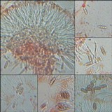 Nephroma laevigatum image