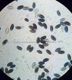 Psathyrella prona image