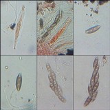Pyrenula macrospora image