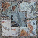 Pyrenula chlorospila image