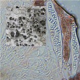 Diploschistes diacapsis image