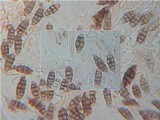 Diploschistes diacapsis image