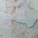 Toninia aromatica image