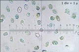 Guepinia helvelloides image