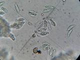 Hypomyces hyalinus image