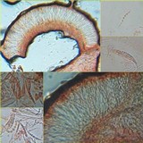 Collema nigrescens image