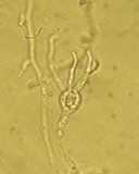 Tremella obscura image