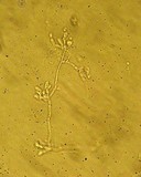 Tremella obscura image